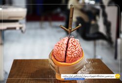 سامانه جراحی هوشمند پارسه